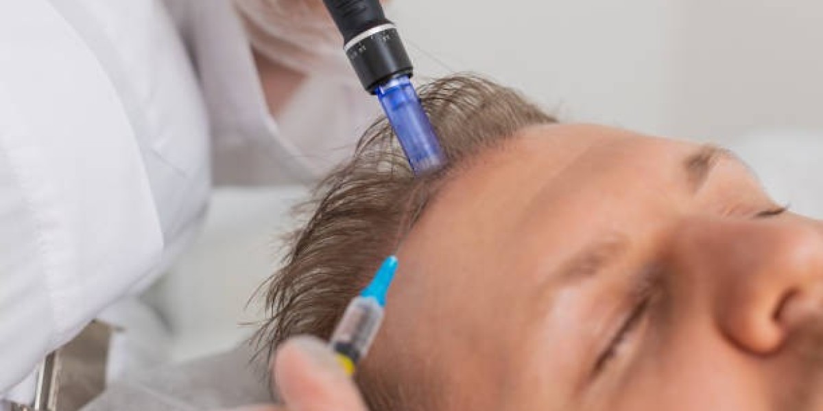 Exosome Hair Treatment: The Non-Surgical Fix in Riyadh