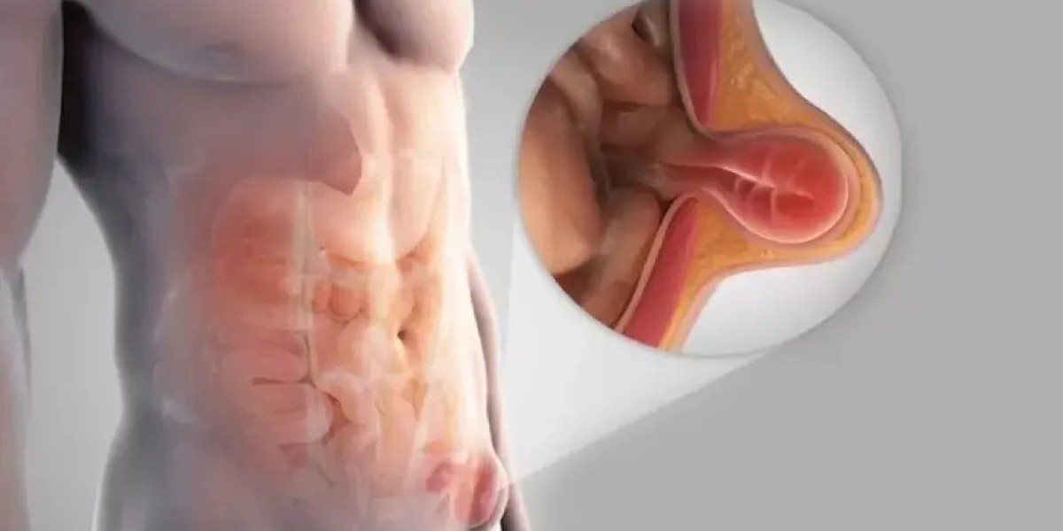How Smoking Impacts Hernia and Its Recovery?