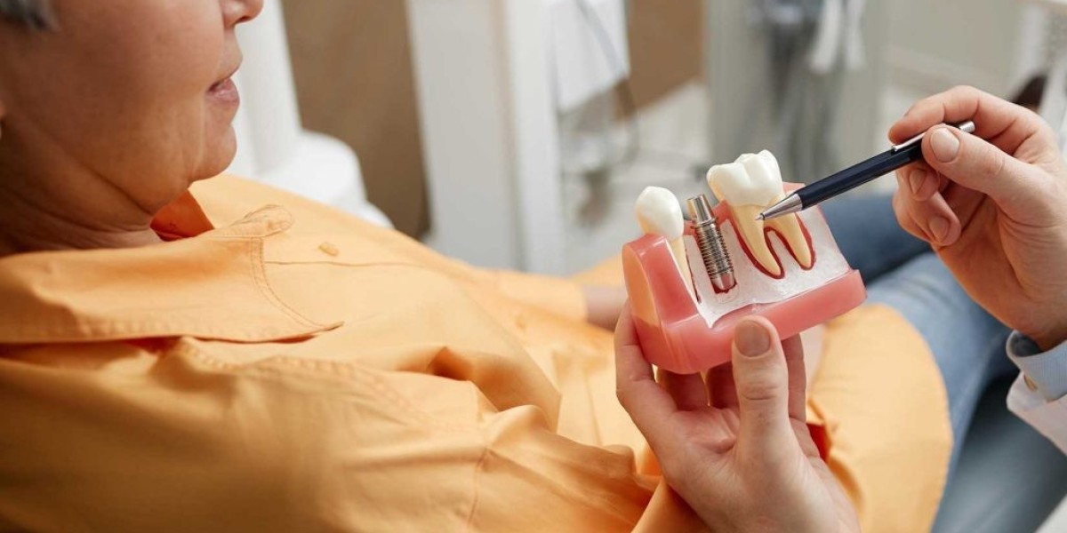 What Your First Same-Day Implant Appointment Will Look Like