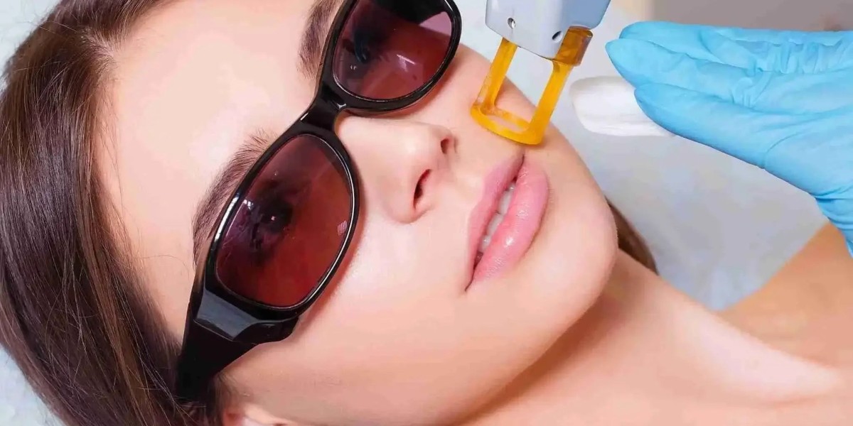 Luxe and Easy: Laser Hair Removal Cost Overview