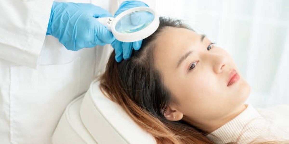 Exosome Hair Loss Treatment Near Me in Riyadh – Fast Results