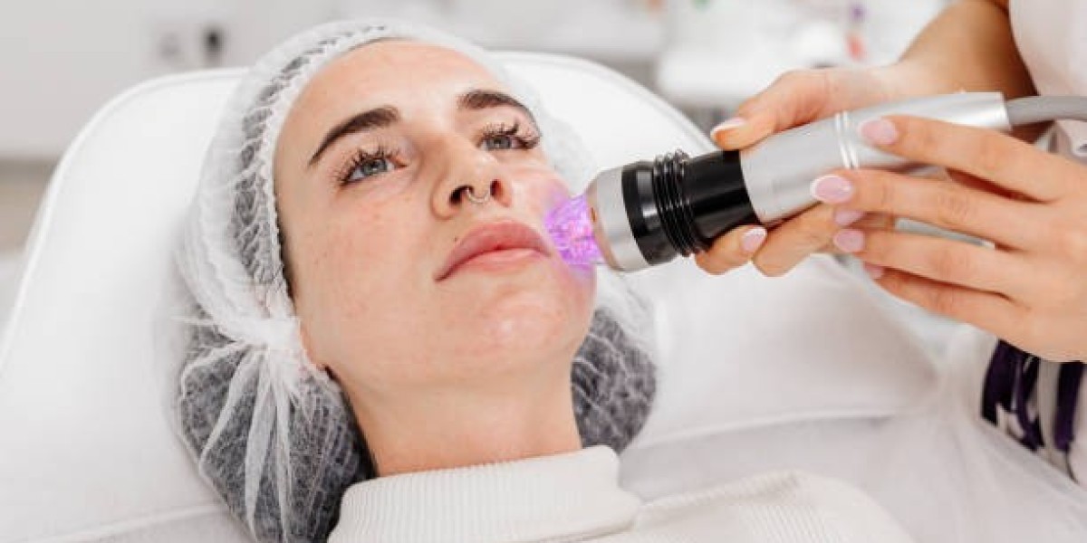 Get Youthful Skin with Derma Pen Sessions