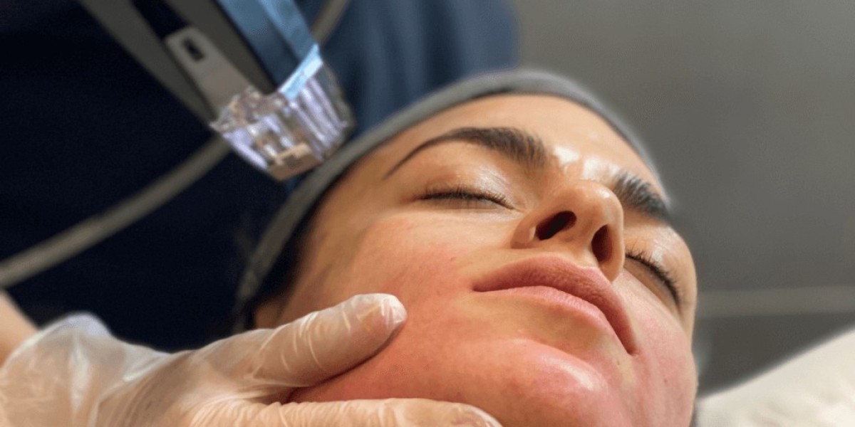 Glowing Skin Starts With Morpheus8 Treatment in Dubai