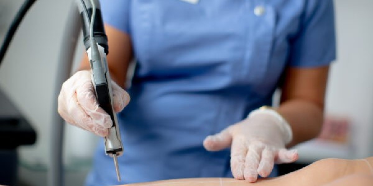 Smooth Skin Solutions: Your Ultimate Guide to Laser Hair Removal southampton