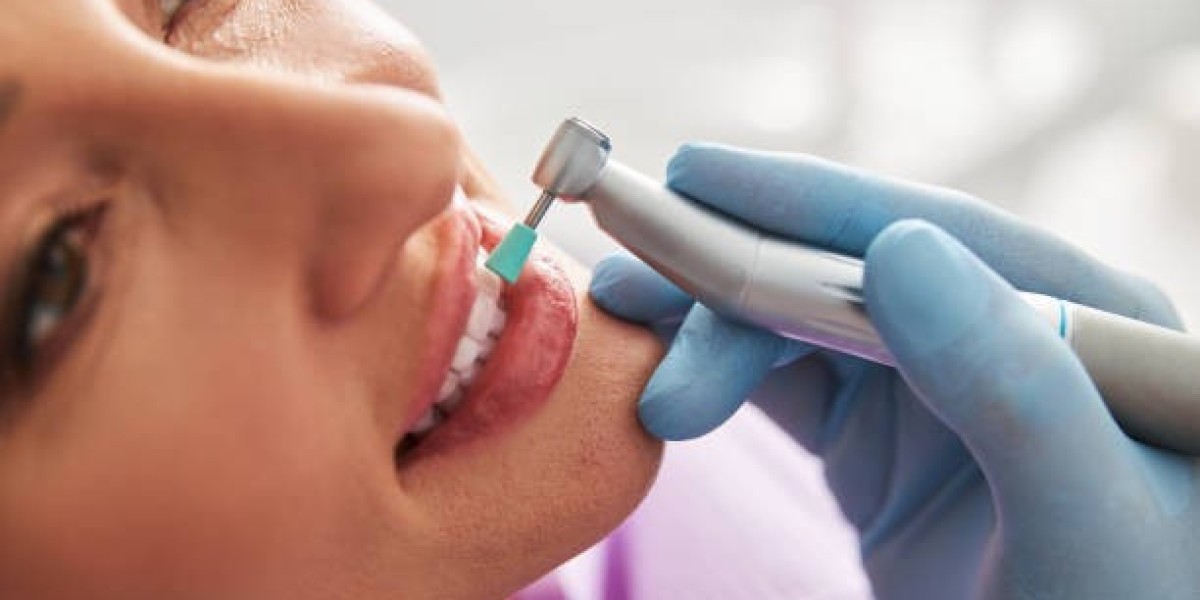 Top 5 Teeth Cleaning and Polishing Benefits