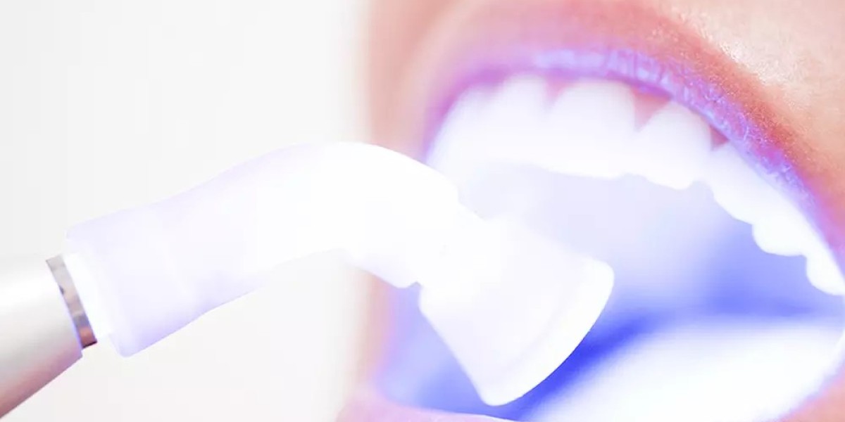 Why Zoom Whitening Is the Most Popular Cosmetic Dental Treatment in 2025