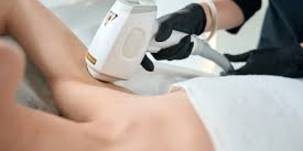 Benefits of Laser Hair Removal in Dubai: Why It's Worth It