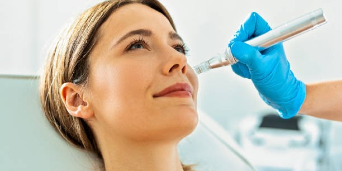 How a Derma Pen Can Help with Acne Scars & Wrinkles