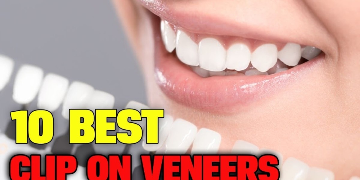 Stunning Smiles on a Budget: How Much Are Veneers in Mexico?
