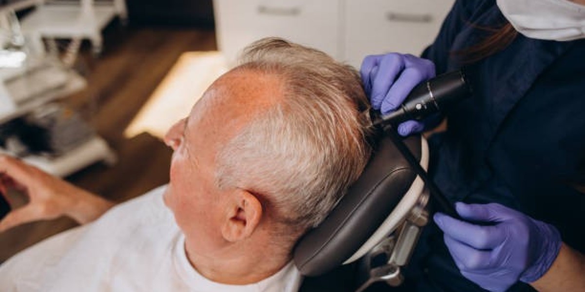 Cost of Hair Transplants in Dubai: What to Expect in 2025