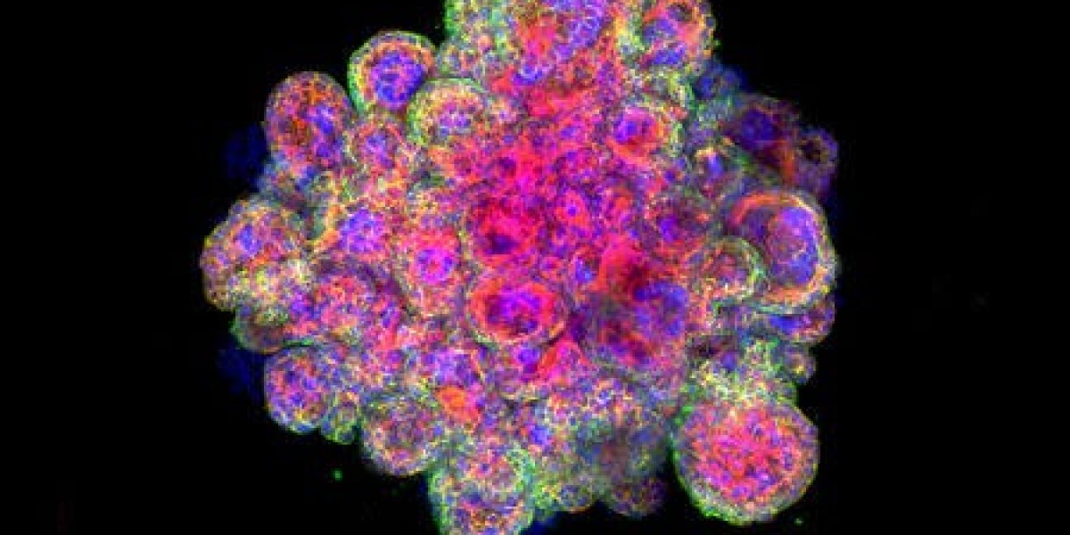 Organoids Market Forecast: How Regulatory Policies and Funding Initiatives Are Accelerating Market Growth and Adoption R