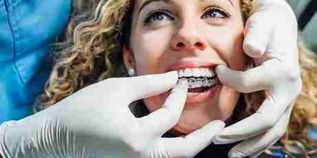 Uncover the Magic of Invisalign for a Flawless Smile