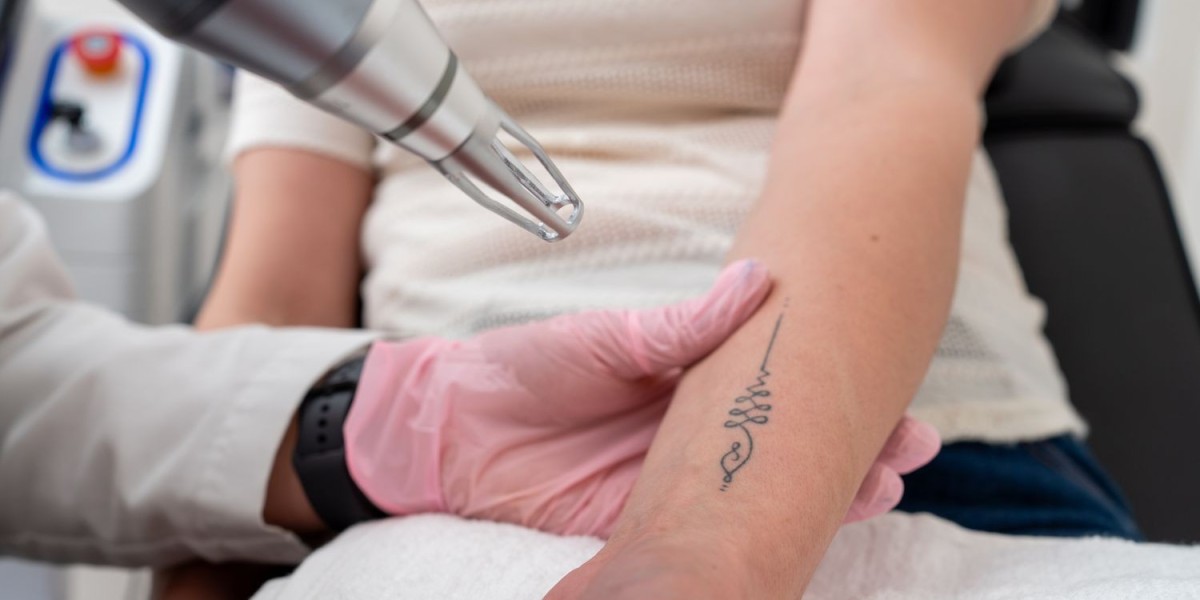 Picosure Tattoo Removal Technology That Targets All Ink Colors