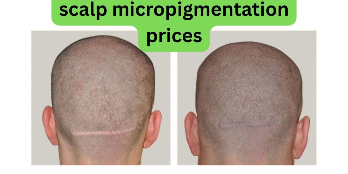 Scalp Micropigmentation Pricing: What It Costs in 2025