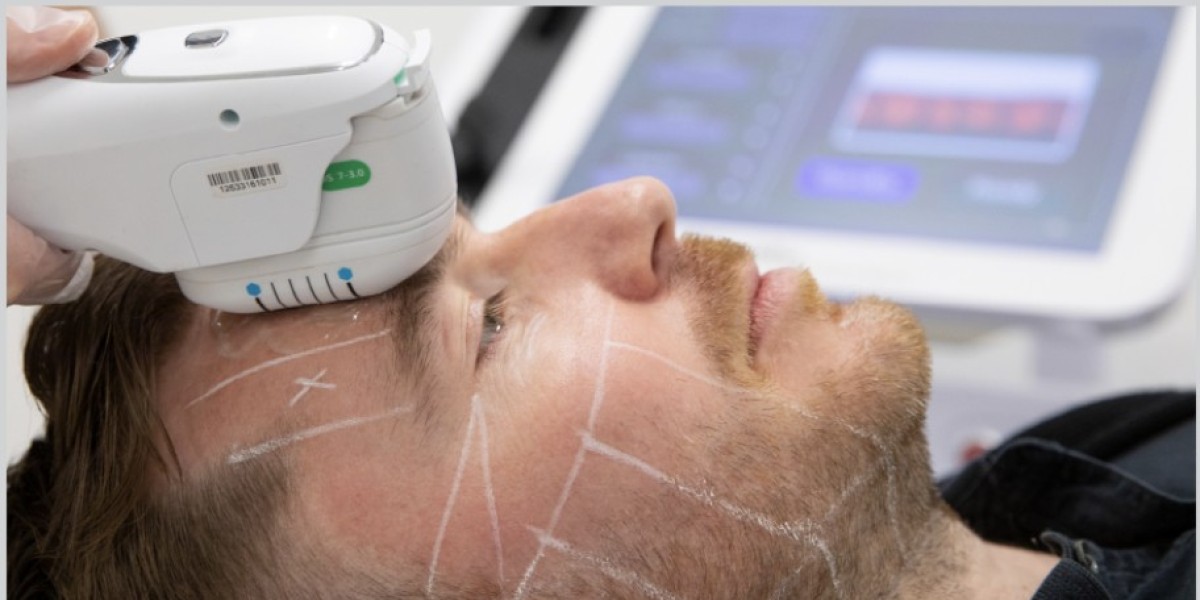 Achieve Radiant Skin: How to Tighten Skin with HIFU Treatment