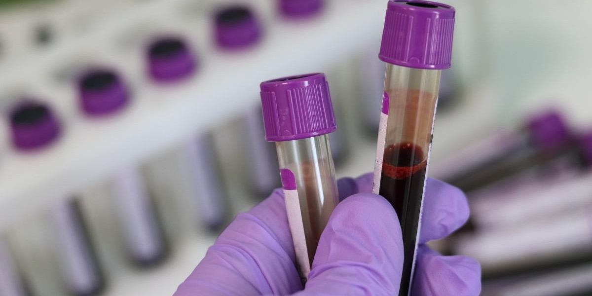 Blood Test at Home in Dubai for Routine Screening
