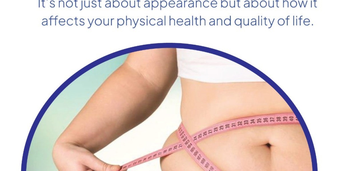Transforming Lives: Obesity Treatment and Bariatric Solutions in the UAE with Dr. Safwan Taha