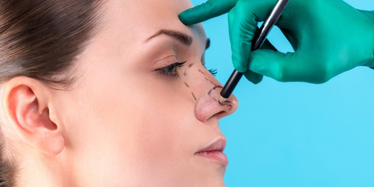 Functional Rhinoplasty in Riyadh: Breathing Better After Surgery