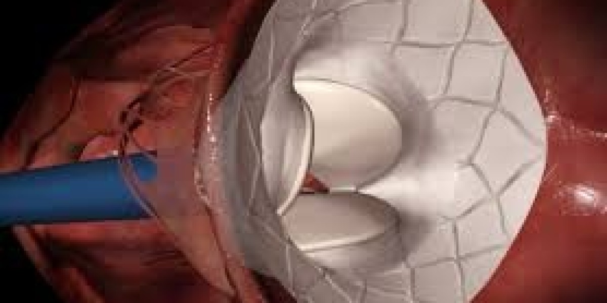 Heart Valve Devices Market: Inhibitors Slowing Adoption and Market Penetration