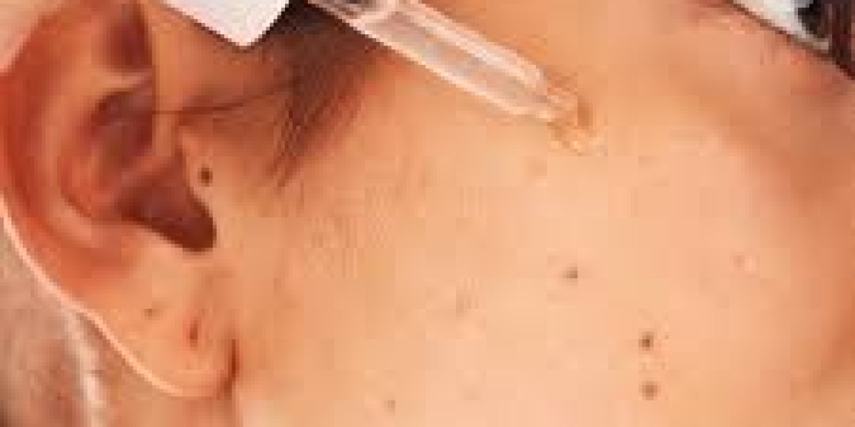 Anti-Acne Cosmetics Market Sustainability Trends Reshaping Packaging and Ingredient Sourcing Across Global Brands