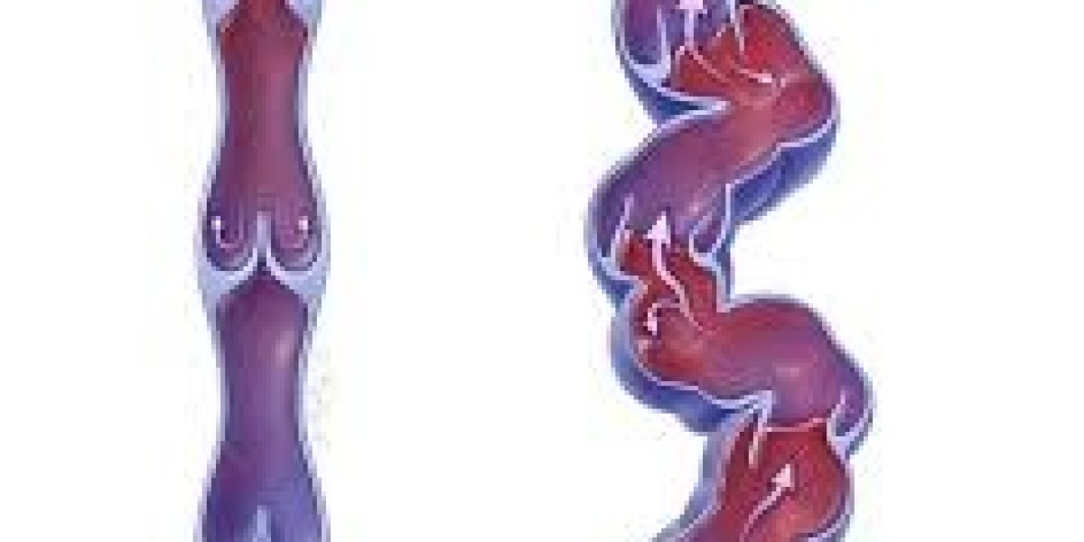 Uncovering Global Compression Therapy Market Size with Key Insights and Share Forecasts