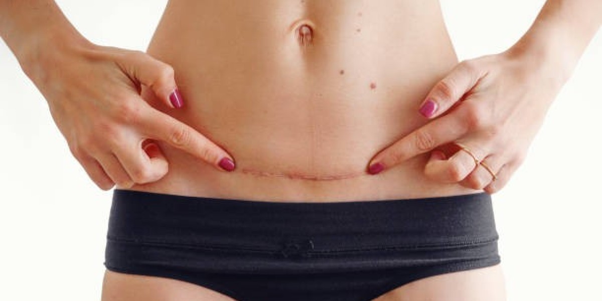 Dubai Scar Removal Clinics: Reviews and Ratings 2025