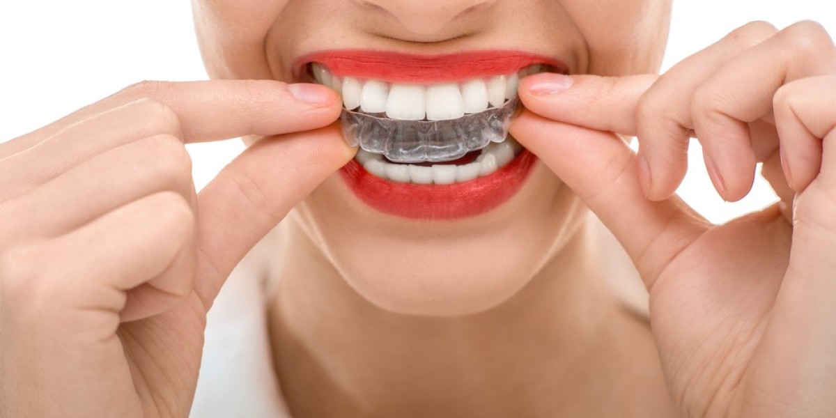 The Real Invisalign Braces Treatment Cost for Adults Today