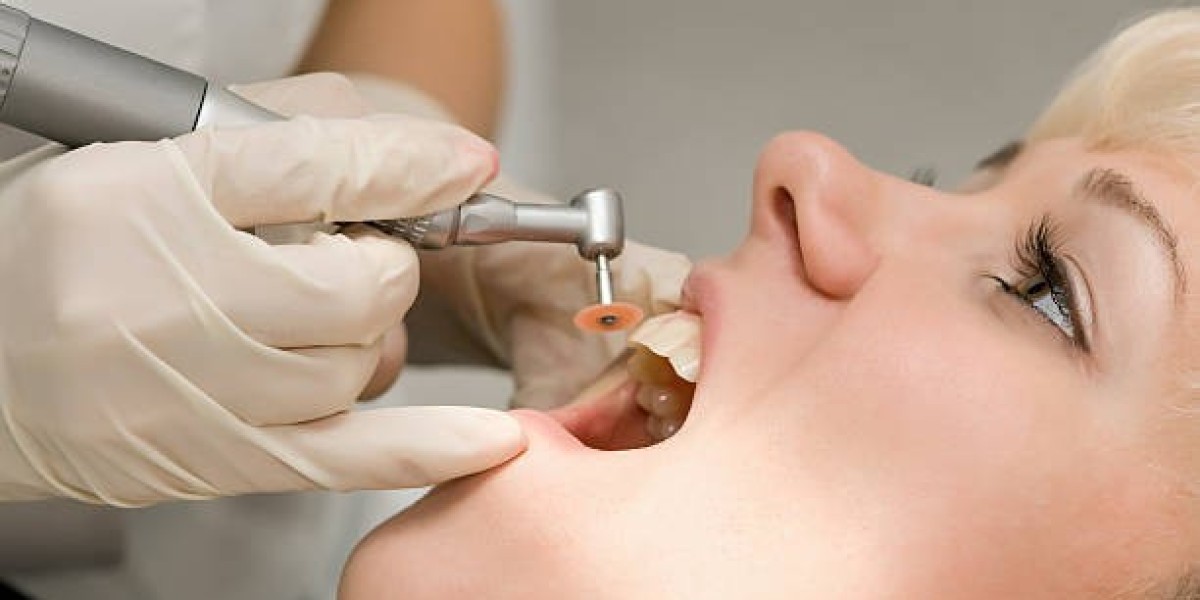Discover the Best Teeth Cleaning and Polishing Services