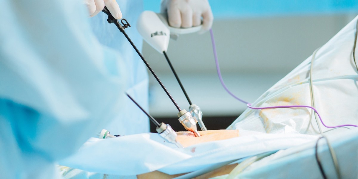 Laparoscopic Devices Market Forecast: Anticipating Global Expansion Trends and New Revenue Streams Through 2030