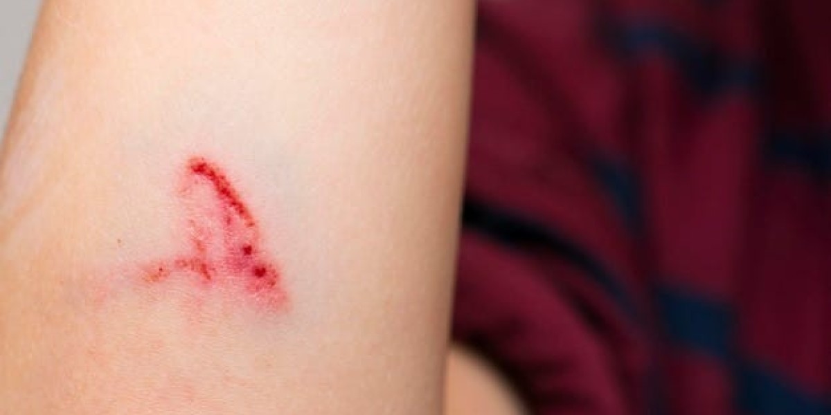 Heal Faster with These Powerful Wound Medicines
