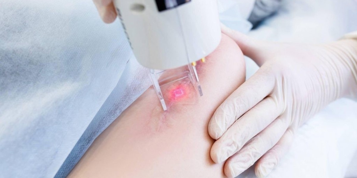 Get Rid of Keloid Scars with Laser in Riyadh