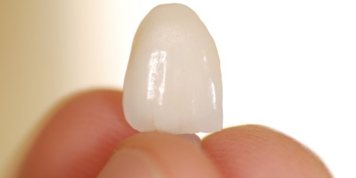 The Rise of Minimally Invasive Dentistry: Spotlight on Non-Prep Veneers