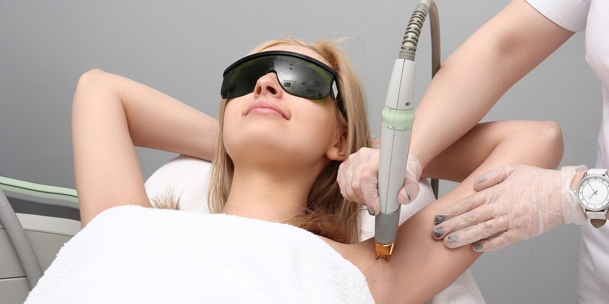 Laser Hair Removal for a More Polished Look