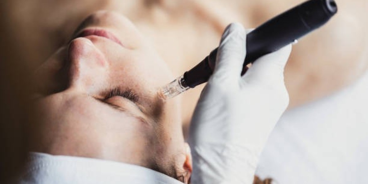 Derma Pen Explained: Benefits, Uses & Results