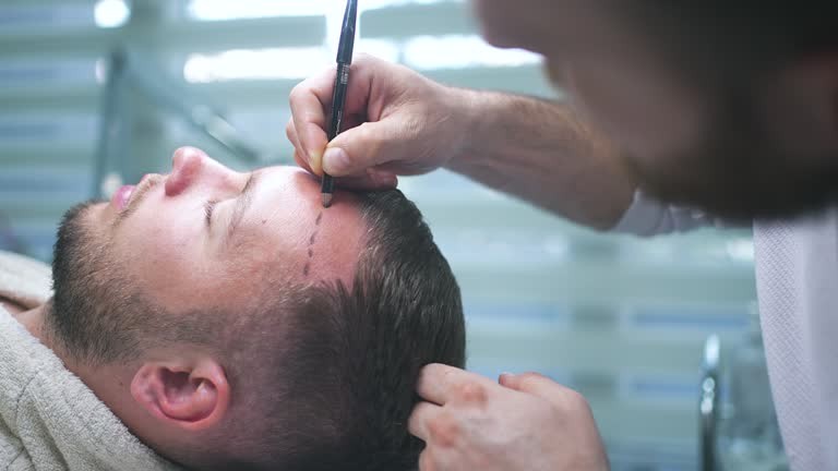 Hair Transplant in Dubai