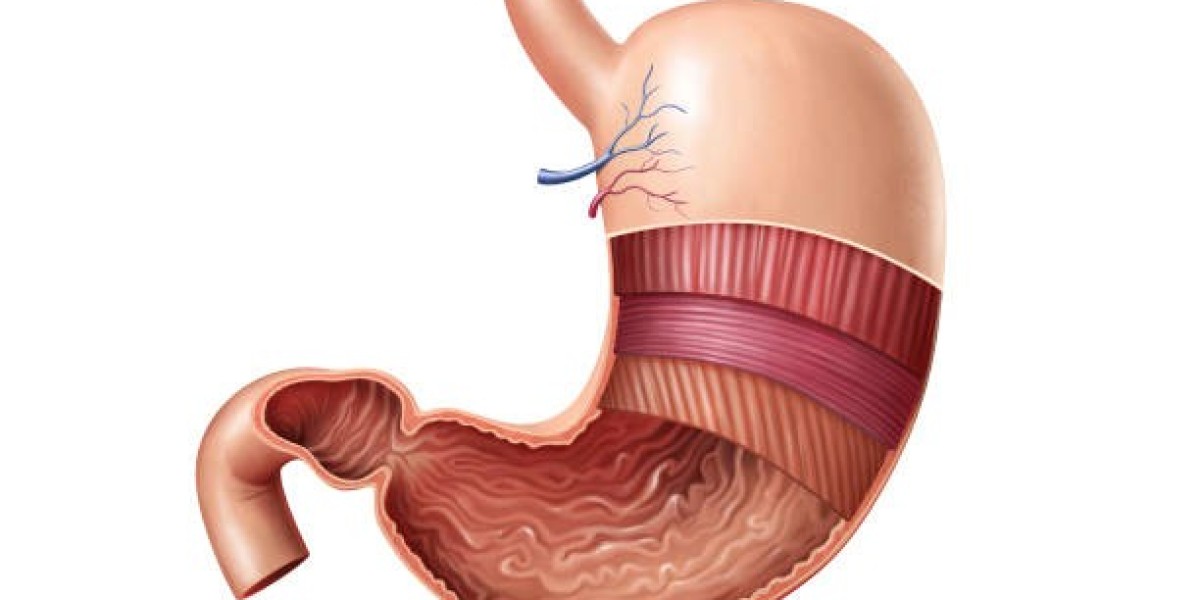 Who Qualifies for Gastric Balloon in Riyadh