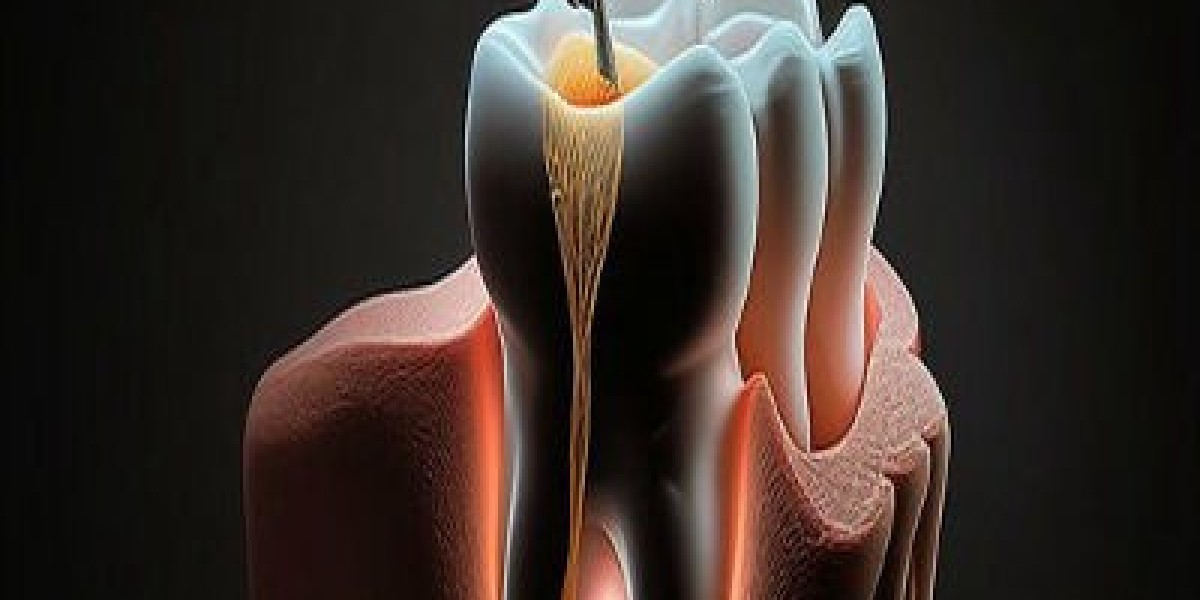 Digital Dentistry & Root Canal: Islamabad Clinics Leading the Way