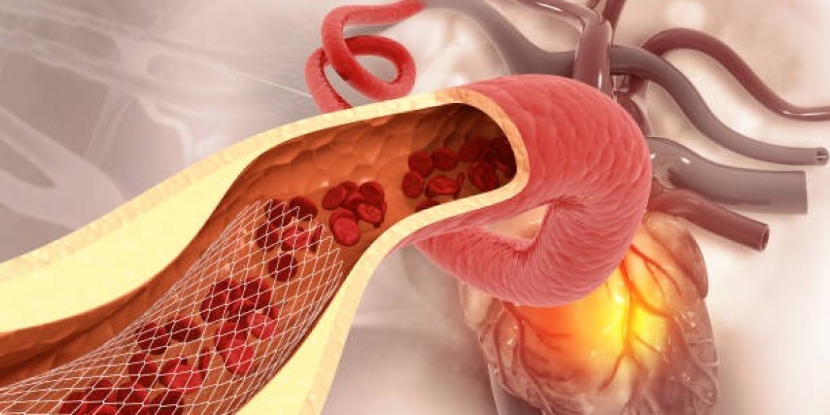 Expert Vascular Surgery Solutions in Riyadh This Year