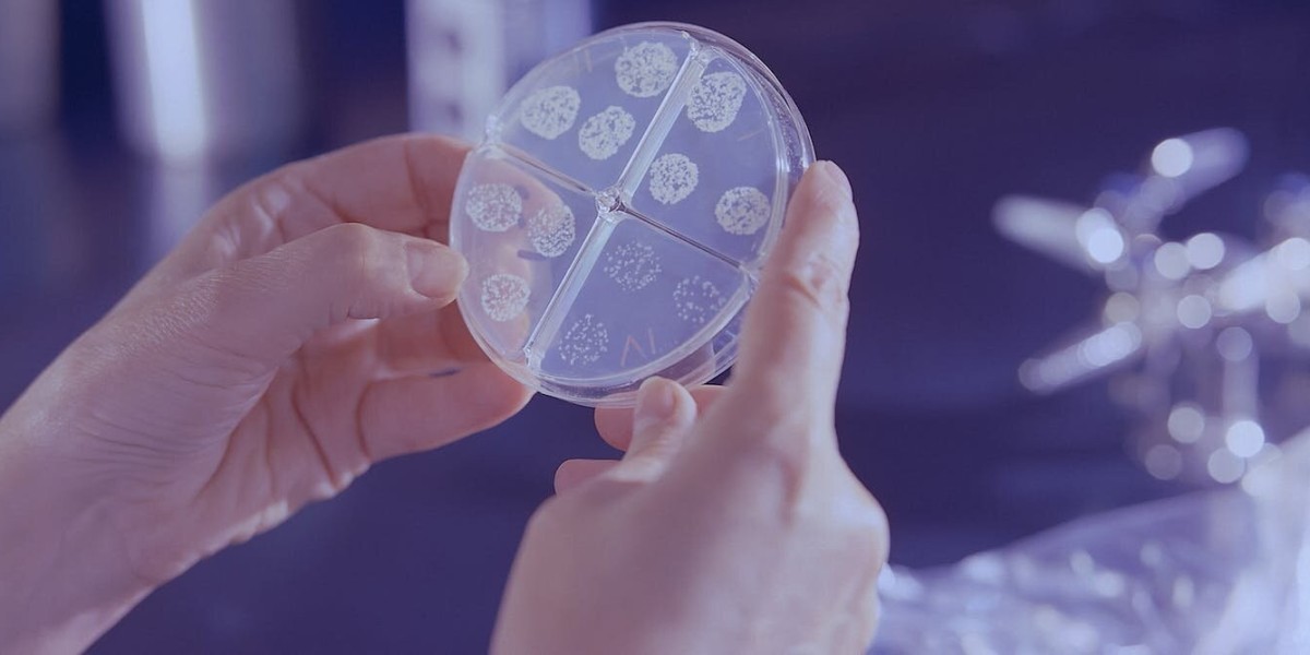 Antimicrobial Polymer Films Market Innovations Shaping the Future of Packaging