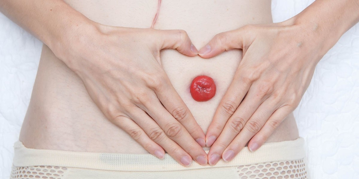 OstomyStoma Care Market Long-Term Outlook Driven by Population Aging and Rising Healthcare Awareness