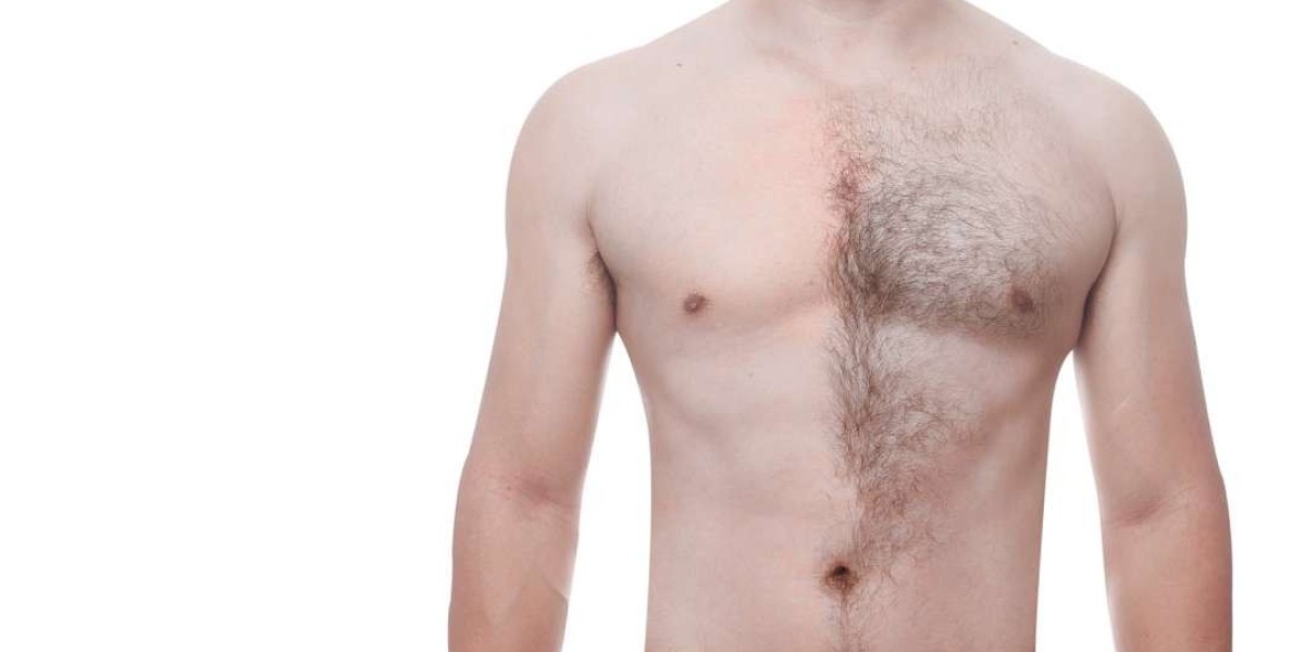 Silky Skin Awaits: Discover Laser Hair Removal in Peshawar