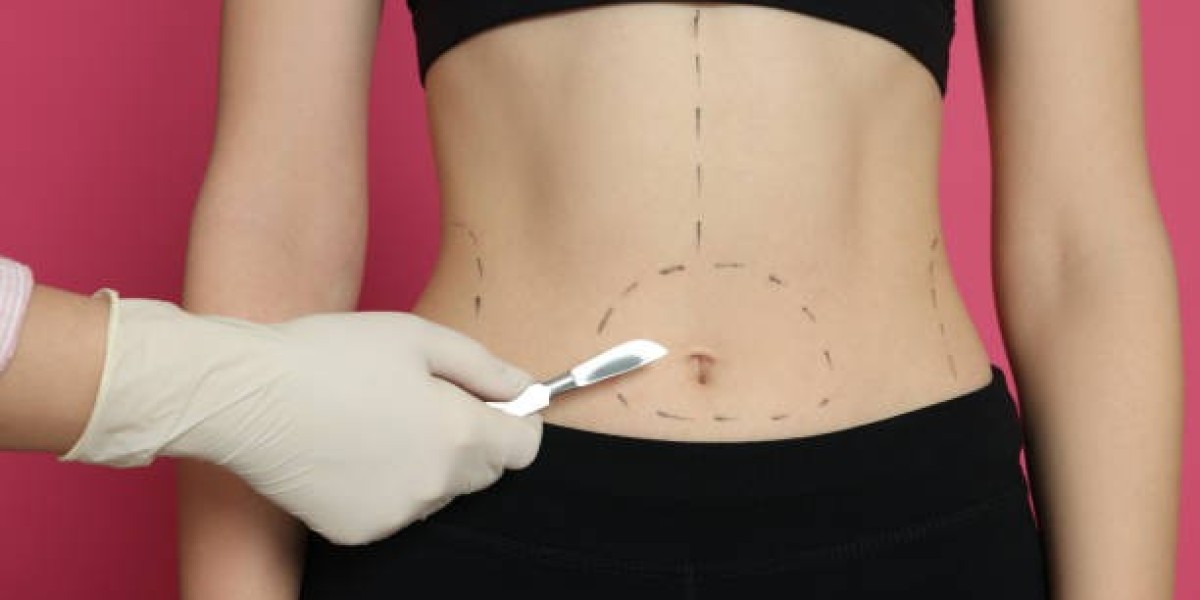 Gastric Sleeve vs Bypass in Riyadh Compared
