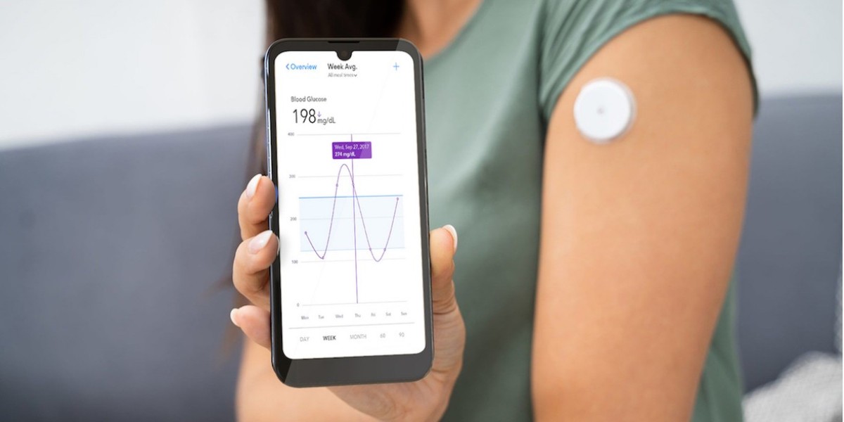 Continuous Glucose Monitoring (CGM) Market: Emerging Trends, Growth Drivers, Challenges, and Future Opportunities Worldw