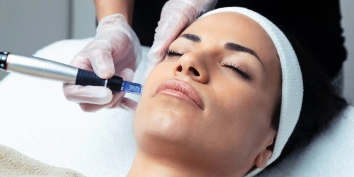 Mesotherapy Aftercare Tips from Riyadh Aesthetic Experts