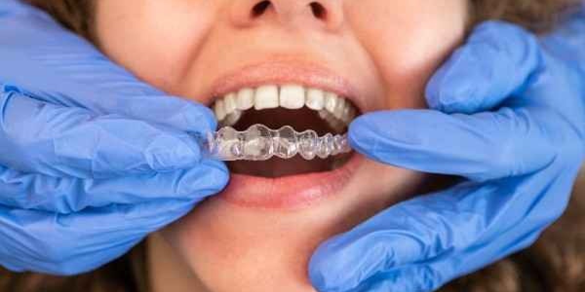 Get a Straighter Smile in Less Time with Invisalign Clear Aligners