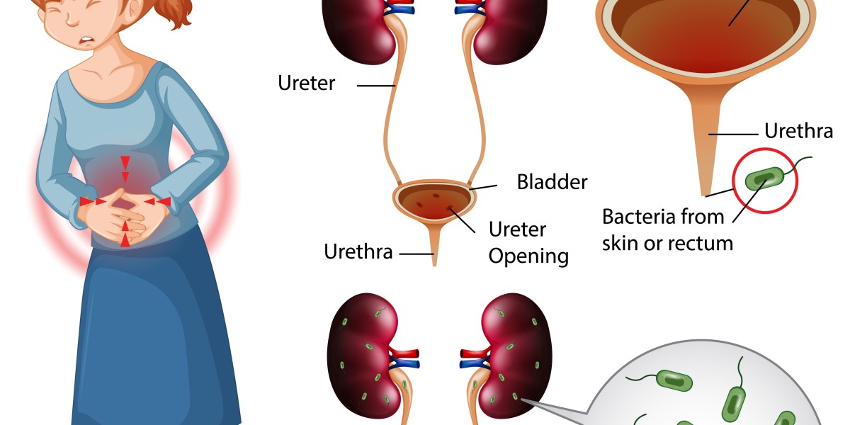 UTI Symptoms? Find Gentle Relief with Dharma Homoeopathy Today!