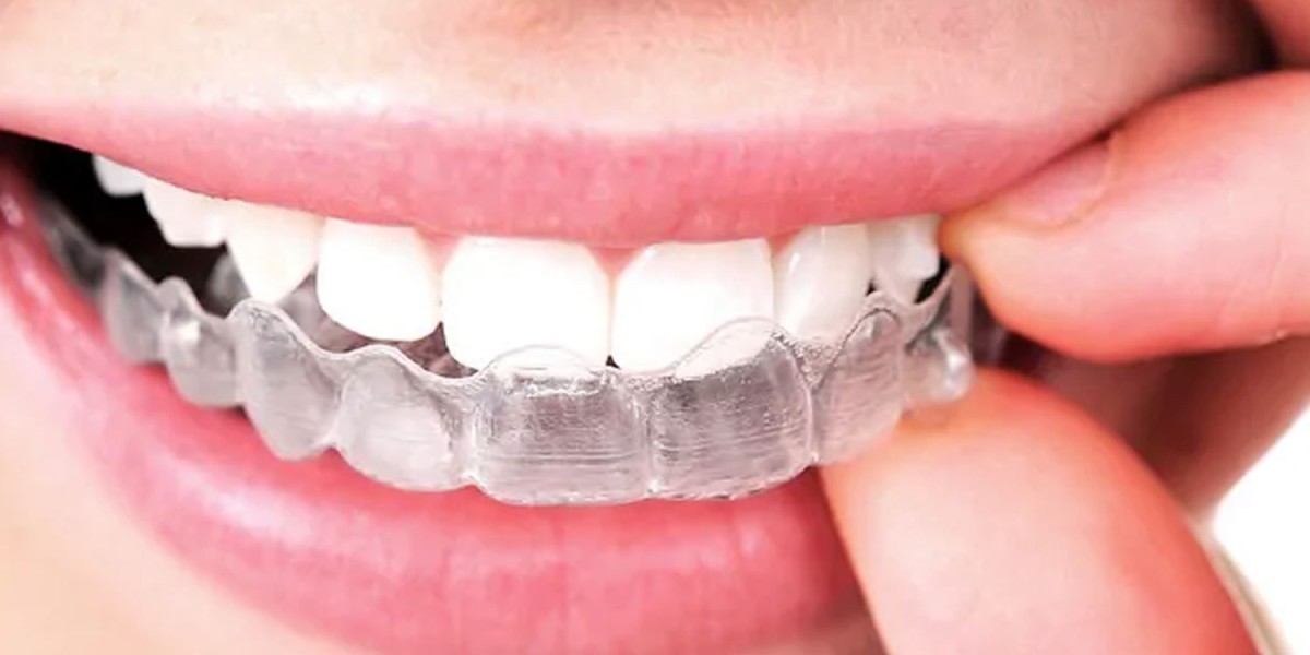 Invisalign Braces Treatment Cost and Why Everyone’s Talking About It