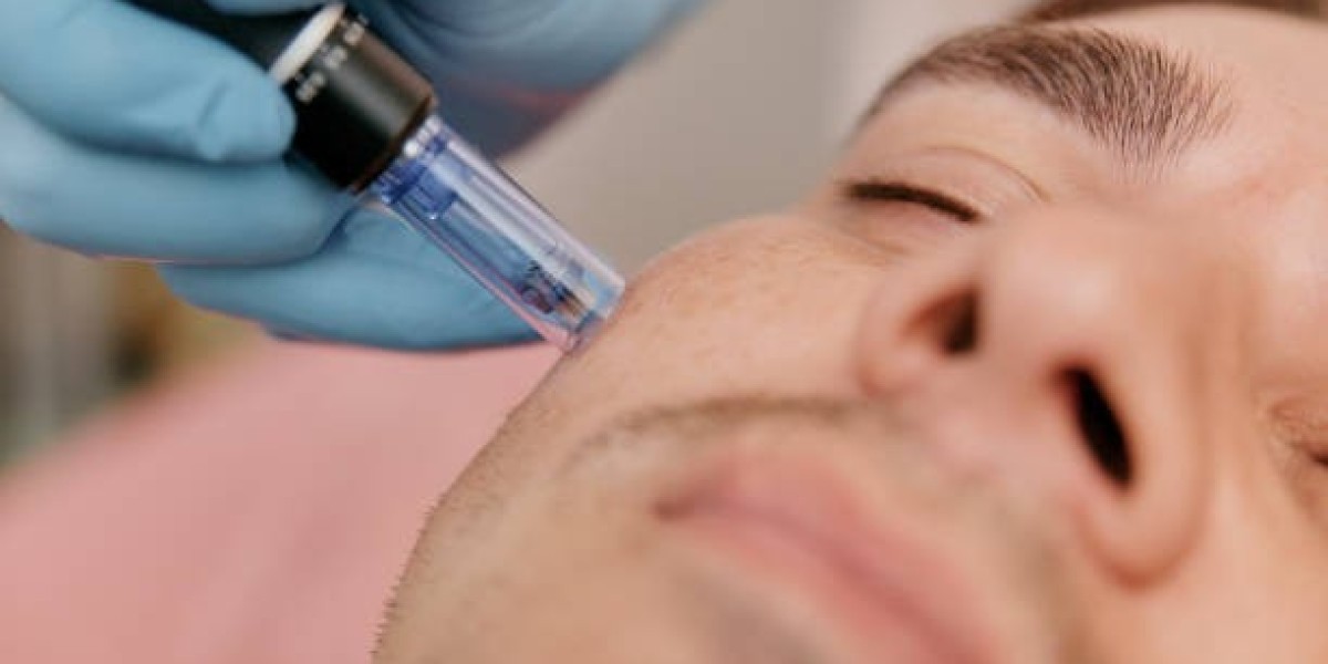 Clearer Skin Fast with Derma Pen Treatment