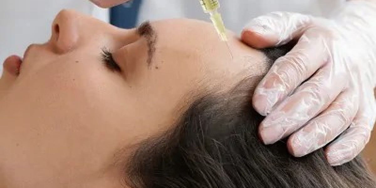PRP Treatment Packages and Discounts in Islamabad