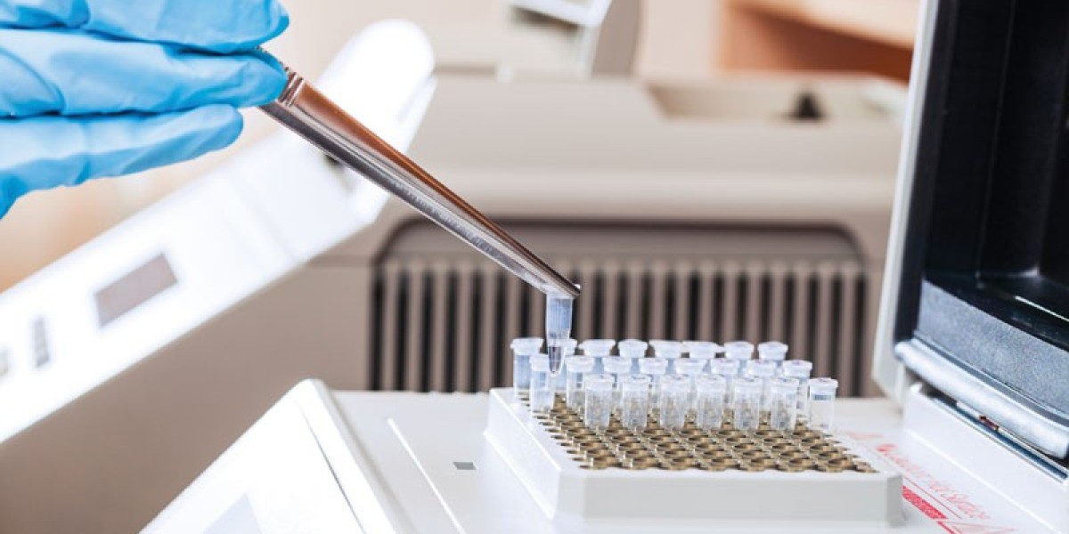 Unlocking Global SVT Market Size with Testing Share Growth and Industry Forecasts